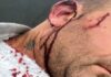 Un intendente fue atacado por un concejal y sufrió lesiones en la cabeza