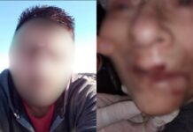 Cuidador de geriátrico enfrenta acusaciones de maltrato a ancianas