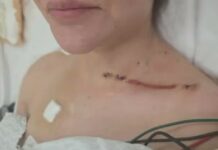 Ex pareja de Cerimedo revela impactantes fotos de sus heridas tras ataque