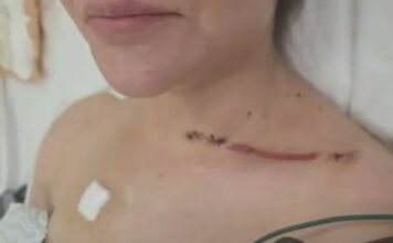Ex pareja de Cerimedo revela impactantes fotos de sus heridas tras ataque