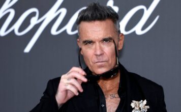 Robbie Williams revela sus luchas internas y considera usar una prótesis capilar
