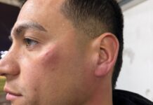 Violencia en el fútbol: Jugadores de Patronato agredidos por sus propios hinchas tras derrota