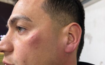 Violencia en el fútbol: Jugadores de Patronato agredidos por sus propios hinchas tras derrota